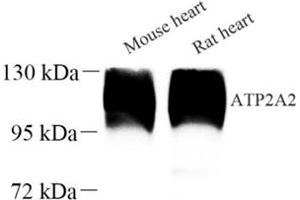 Western blot analysis of ATP2A2 (ABIN7075545) at dilution of 1: 500 (SERCA2 ATPase antibody)