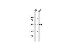 Lane 1: 293, Lane 2: Hela whole cell lysate at 20 µg per lane, probed with TRAF2 (214CT16. (TRAF2 antibody)