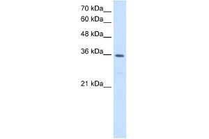MTHFD2 antibody used at 1. (MTHFD2 antibody)