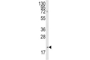 Western Blotting (WB) image for anti-Bcl2 Modifying Factor (BMF) (BH3 Domain) antibody (ABIN2997142) (BMF antibody  (BH3 Domain))