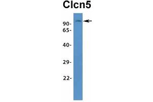 Western Blotting (WB) image for anti-Chloride Channel 5 (CLCN5) (Middle Region) antibody (ABIN2776081)