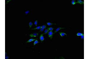 Immunofluorescent analysis of Hela cells using ABIN7173207 at dilution of 1:100 and Alexa Fluor 488-congugated AffiniPure Goat Anti-Rabbit IgG(H+L)
