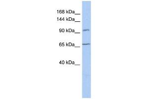 WB Suggested Anti-COG5 Antibody Titration:  0. (COG5 antibody  (N-Term))