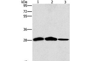 Western Blot analysis of Mouse liver and Human chromaffin cell tumor tissue, hepG2 cell using SPR Polyclonal Antibody at dilution of 1:1500 (SPR antibody)