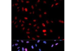 Immunofluorescence (IF) image for anti-Structural Maintenance of Chromosomes 1A (SMC1A) (pSer957) antibody (ABIN7265084)