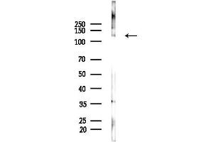 anti-Collagen, Type III (COL3) (N-Term) antibody