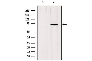 Western blot analysis of extracts from Mouse Myeloma cell, using MTA3 antibody.