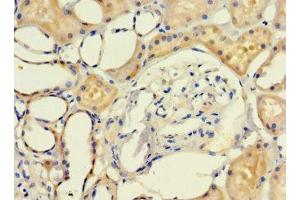 Immunohistochemistry of paraffin-embedded human kidney tissue using ABIN7158049 at dilution of 1:100 (LRCH1 antibody  (AA 1-105))