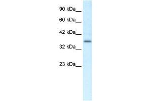 WB Suggested Anti-CMKLR1 Antibody Titration:  0.