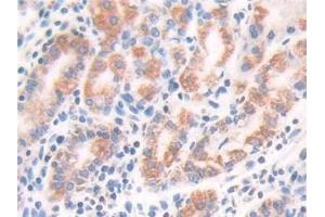 Detection of ECH1 in Human Stomach Tissue using Polyclonal Antibody to Enoyl Coenzyme A Hydratase 1, Peroxisomal (ECH1) (ECH1 antibody  (AA 1-328))