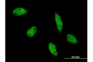Immunofluorescence of monoclonal antibody to TFAP2B on HeLa cell. (TFAP2B antibody  (AA 1-449))
