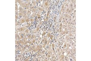 Immunohistochemistry of paraffin-embedded human liver using DC Rabbit mAb (ABIN7266685) at dilution of 1:200 (40x lens). (DCAF7 antibody)