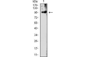 Western Blotting (WB) image for anti-PMS2 Postmeiotic Segregation Increased 2 (S. Cerevisiae) (PMS2) (AA 748-851) antibody (ABIN7193481)