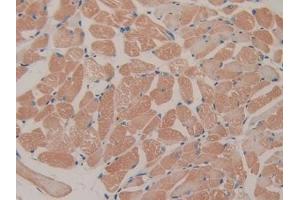 DAB staining on IHC-P; Samples: Mouse Skeletal muscle Tissue (FES antibody  (AA 510-770))
