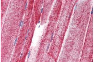 Human Skeletal Muscle (formalin-fixed, paraffin-embedded) stained with UNC93B antibody ABIN343917 at 5 ug/ml followed by biotinylated goat anti-rabbit IgG secondary antibody ABIN481713, alkaline phosphatase-streptavidin and chromogen. (UNC93B1 antibody  (N-Term))