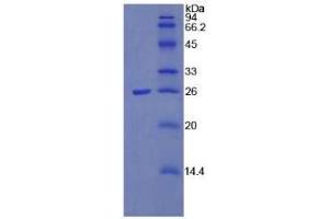SDS-PAGE analysis of Mouse Pentraxin 3 Protein.