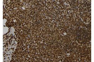ABIN6278533 at 1/100 staining Mouse spleen tissue by IHC-P. (SNCAIP antibody  (Internal Region))