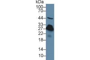 Western Blot; Sample: Rat Serum; Primary Ab: 3µg/ml Rabbit Anti-Rat CRP Antibody Second Ab: 0. (CRP antibody  (AA 20-230))