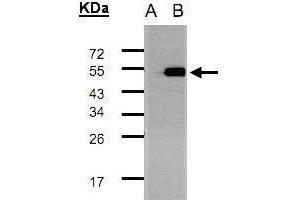 WB Image Western Blot analysis of TADA3L expression in transfected 293T cell line by TADA3L polyclonal antibody. (TADA3L antibody  (C-Term))