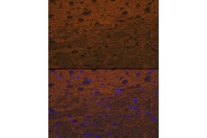 Immunofluorescence analysis of rat brain cells using Syntaxin Rabbit mAb (ABIN7270685) at dilution of 1:100 (40x lens). (Syntaxin 1B antibody)