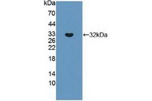 Detection of Recombinant ABCC8, Human using Polyclonal Antibody to ATP Binding Cassette Transporter C8 (ABCC8) (ABCC8 antibody  (AA 679-929))
