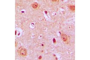 Immunohistochemical analysis of PTGR2 staining in human brain formalin fixed paraffin embedded tissue section. (PTGR2 antibody  (Center))