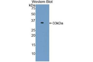 Western blot analysis of the recombinant protein. (TNNI3 antibody  (AA 1-211))