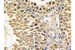 ABIN6257100 and ABIN6275625 at 1/100 staining rat testis tissue by IHC-P.