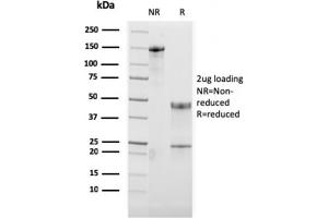 SDS-PAGE Analysis Purified OX40 Mouse Monoclonal Antibody (OX40/3108). (TNFRSF4 antibody  (AA 59-205))