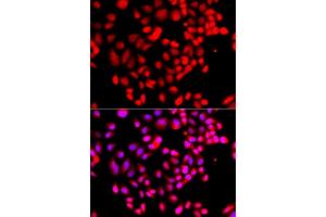 Immunofluorescence analysis of  cells using RPS6KL1 antibody (ABIN6130681, ABIN6147242, ABIN6147243 and ABIN6223376).