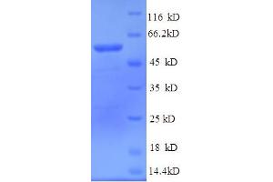 SDS-PAGE (SDS) image for 5'-Nucleotidase, Cytosolic IA (NT5C1A) (AA 1-368), (full length) protein (His tag) (ABIN5714472) (NT5C1A Protein (AA 1-368, full length) (His tag))