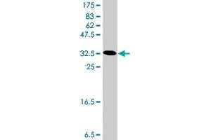 Western Blot detection against Immunogen (36. (LRP5 antibody  (AA 41-130))