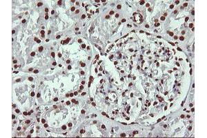 Image no. 8 for anti-THUMP Domain Containing 1 (THUMPD1) antibody (ABIN1501384) (THUMPD1 antibody)