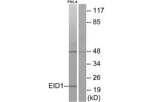 Western blot analysis of extracts from HeLa cells, using EID1 antibody. (EID1 antibody  (Internal Region))