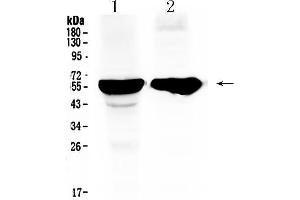 Western blot analysis of Cytochrome P450 2D6 using anti- Cytochrome P450 2D6 antibody . (CYP2D6 antibody  (C-Term))
