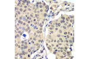 Immunohistochemistry (Paraffin-embedded Sections) (IHC (p)) image for anti-Cyclin C (CCNC) (AA 1-283) antibody (ABIN6138076)