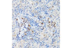 Immunohistochemistry of paraffin-embedded Mouse cartilage using Aggrecan Rabbit pAb (ABIN6127417, ABIN6136406, ABIN6136408 and ABIN6224631) at dilution of 1:50 (40x lens). (Aggrecan antibody  (AA 20-280))
