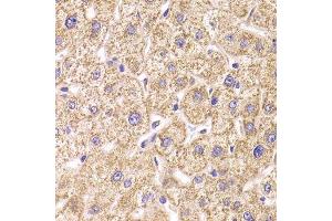 Immunohistochemistry of paraffin-embedded human liver injury using ST3GAL3 antibody.