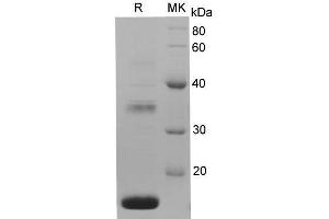 Western Blotting (WB) image for Regenerating Islet-Derived Family, Member 4 (REG4) protein (His tag) (ABIN7321294) (REG4 Protein (His tag))