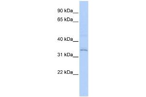 WB Suggested Anti-RNF113A Antibody Titration:  0. (RNF113A antibody  (Middle Region))