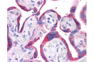DLL1 antibody was used for immunohistochemistry at a concentration of 4-8 ug/ml. (DLL1 antibody)