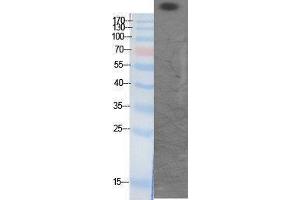 Western Blotting (WB) image for anti-CREB Binding Protein (CREBBP) (acLys1535) antibody (ABIN3172825) (CBP antibody  (acLys1535))