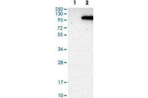 Western Blot analysis of Lane 1: negative control (vector only transfected HEK293T cell lysate) and Lane 2: over-expression lysate (co-expressed with a C-terminal myc-DDK tag in mammalian HEK293T cells) with PDE6A polyclonal antibody .