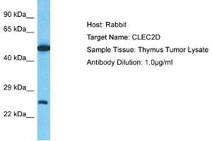 Western Blotting (WB) image for anti-C-Type Lectin Domain Family 2, Member D (CLEC2D) (C-Term) antibody (ABIN2781886)