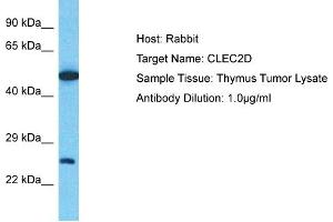 Host: Rabbit Target Name: CLEC2D Sample Type: Thymus Tumor lysates Antibody Dilution: 1. (CLEC2D antibody  (C-Term))