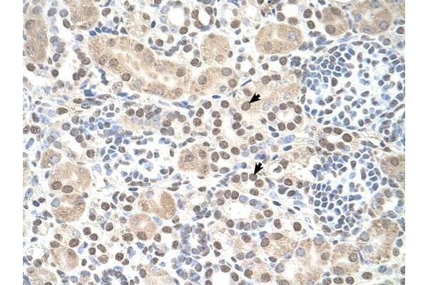 ST8SIA2 antibody  (C-Term)