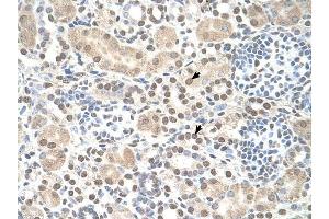 ST8SIA2 antibody was used for immunohistochemistry at a concentration of 4-8 ug/ml to stain Epithelial cells of renal tubule (arrows) in Human Kidney.