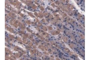 Detection of LCT in Rat Stomach Tissue using Polyclonal Antibody to Lactase (LCT) (LCT antibody  (AA 33-291))