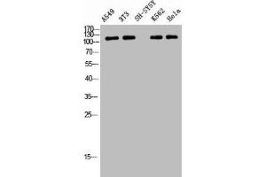 Western Blot analysis of A549 NIH-3T3 SH-SY5Y K562 HELA cells using Phospho-Tensin-2 (Y483) Polyclonal Antibody