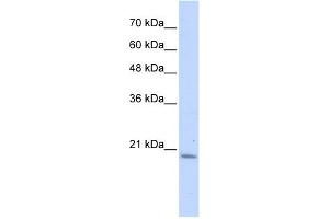 WB Suggested Anti-PFDN6 Antibody Titration: 0. (PFDN6 antibody  (N-Term))